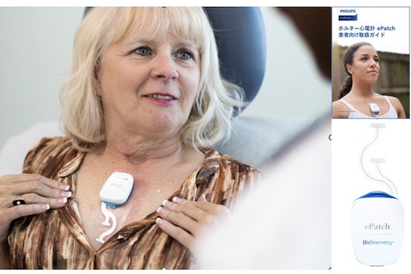 フィリップスePatch(ホルター心電計)